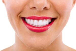 Close-up of woman’s smile with beautiful teeth